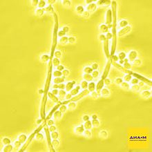 Зимолиаза 20T из Arthrobacter luteus, лиофильный порошок, 20 000 ед/г, MP Biomedicals