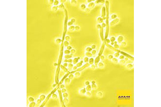 Зимолиаза 100T из Arthrobacter luteus, лиофильный порошок, 100 000 ед/г, MP Biomedicals