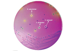 Агар HiCrome для выделения и идентификации Enterobacter sakazakii 500 г (ФСЗ 2009/03705