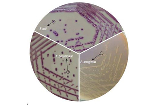 Агар HiCrome ECC для дифференциации E.coli и колиформных бактерий 500 г (ФСЗ 2009/03705
