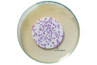 Агар HiCrome для обнаружения термотолерантных E.coli мембранным методом 100 г (ФСЗ 2009/03705)