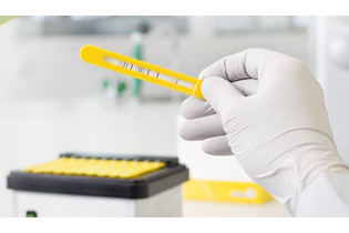 Панель 1 (7 пищевых + 13 респираторных аллергенов) RIDA® AllergyScreen, 10 тестов