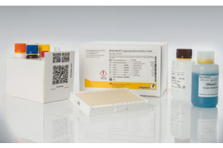 Лейшмании, IgG, полуколичеств., 96х01