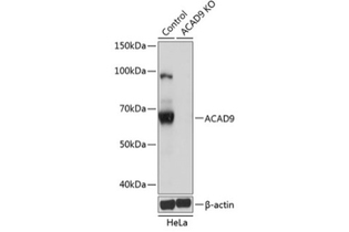 Антитела [KO Validated] ACAD9 кроличьи, поликлональные, ABclonal